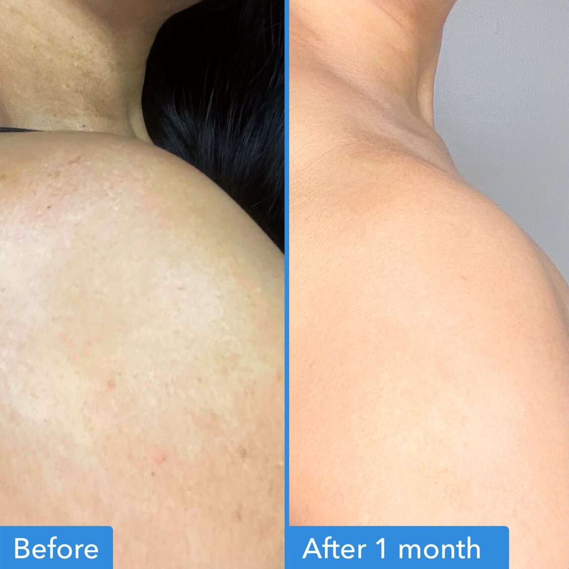 discoloration-correcting-body-treatment-q3 zb_p.jpg