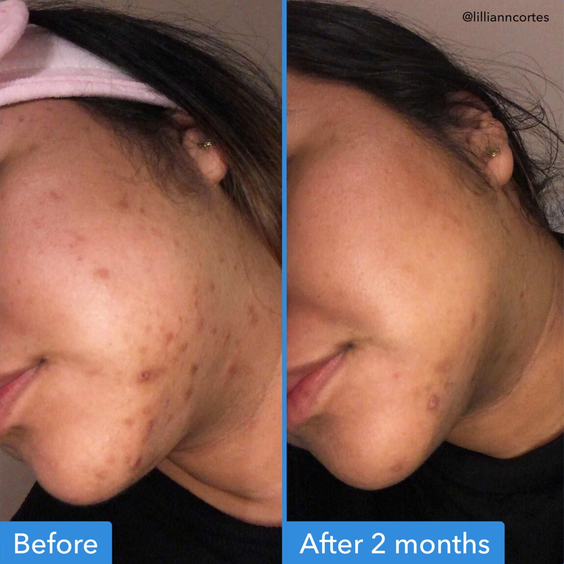 discoloration-correcting-serum-g4 zb_p.jpg